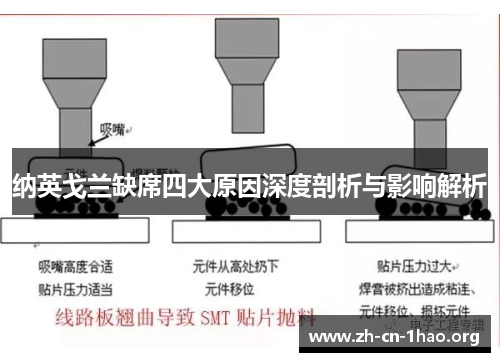 纳英戈兰缺席四大原因深度剖析与影响解析